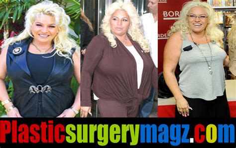 Beth Chapman Plastic Surgery Before And After Pictures Plastic