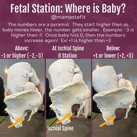 3 Pelvic Levels Of Fetal Station Understand Where Baby Is