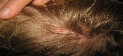تفسير حلم ازالة الشعر للعزباء ازالة الشعر للعزباء او نتف الشعر في المنام للعزباء يرمز الي اقتراب موعد زواجها. الشعر الطويل في المنام للعزباء - yoyok soebagiu