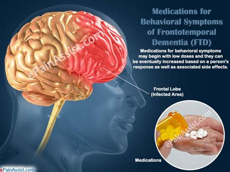 Home 11 23 15 are there subtypes of dementia as alzheimer's disease and related dementias re. Dementia: Causes, Symptoms & Treatments | Global Treatment ...