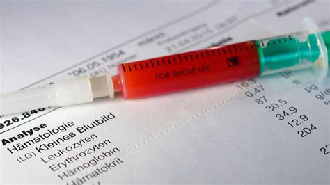 Small Blood Count The 8 Crucial Blood Values You Need To Know For