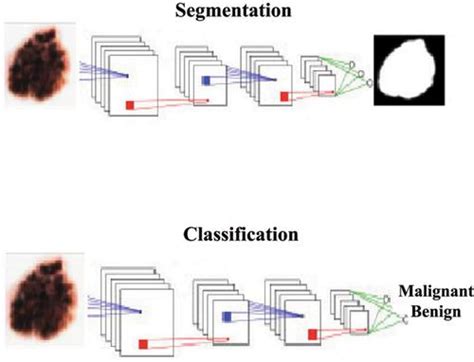 Deep Learning Approaches Towards Skin Lesion Segmentation And