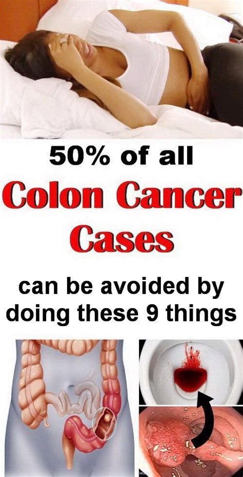 4 Colon Cancer Signs And Symptoms That Are Often Ignored By Many People