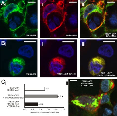 Evaluation Of Cellular Localization Of Fluorescently Labeled Trek1
