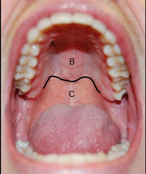 Inside Teeth Parts