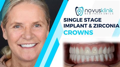 Welcome to Novusklinik , where cutting-edge technology meets dental