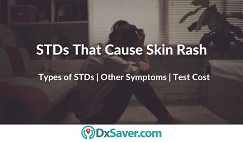 Types Of Stds That Cause Rash On Body And Other Std Symptoms