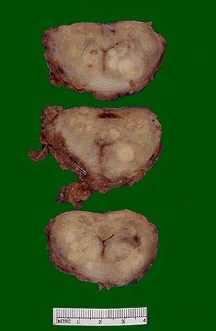 I was one of the sheep. The Making of a Pathologists' Assistant: Studying ...