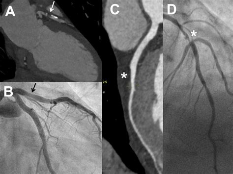 Use Of Coronary Computed Tomography Angiography In Clinical Practice