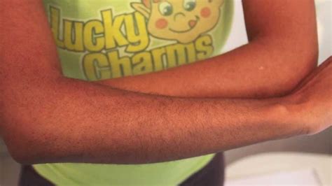 Ipl, an acronym for intense pulsed light, is sorta similar to laser hair removal in that it uses light to poof underarm hair away. How to make your ARM HAIRS less noticeable WITHOUT shaving ...