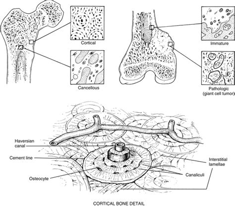 Bone Healing | Musculoskeletal Key