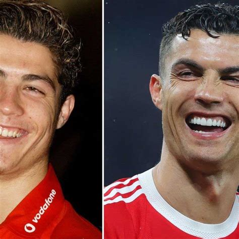 Cristiano Ronaldo Teeth
