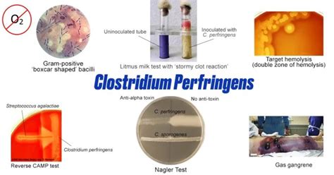 Clostridium Perfringens Properties Diseases And Diagnosis Learn