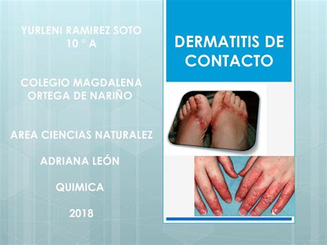 Calaméo Dermatitis De Contacto