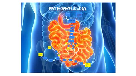 Pathophysiology Of Complete Mechanical Bowel Obstruction With