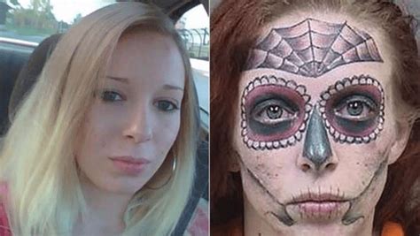 Alyssa Zebraskys Face Tattoo Removal Journey Removery