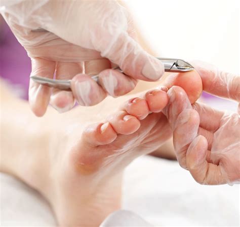 Foot Care Treatments In Ottawa Natural Sole Wellness