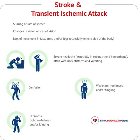 Transient Ischemic Stroke Symptoms