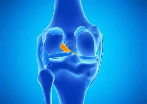 Revision Acl Reconstruction Knee Surgeon Vail Aspen Colorado