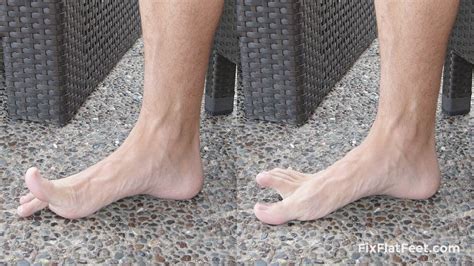 Exercises For Flat Feet