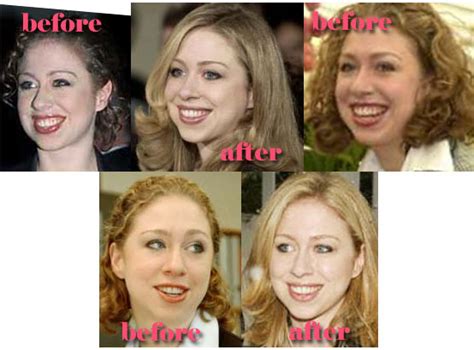 THE CLINTONS' GREATEST SHAME: CHELSEA CLINTON IS THE ...