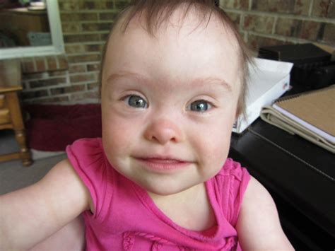 Things to Know About Down Syndrome - Physical Traits | Carrie with Children gambar png