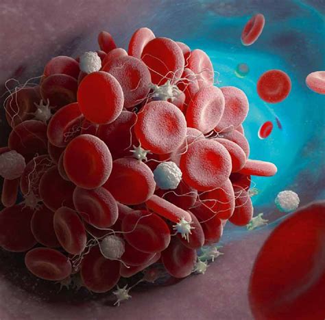 Let's change the world together. Bekijk nu Hematologie Actueel, najaar 2020 - NTVH