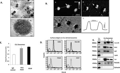 Characterization Of Cll Derived Exosomes A Transmission Electron