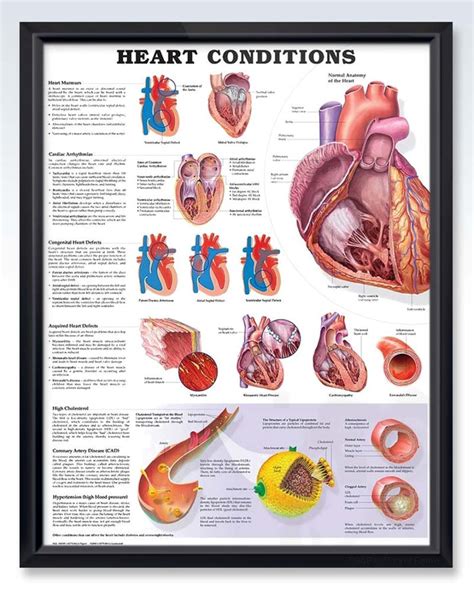 Heart Conditions Exam Room Human Anatomy Posters Clinicalposters