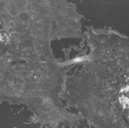 Do plant cells go through cytokinesis. Cleavage furrow - Wikipedia
