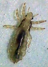 Can Lice Jump Images