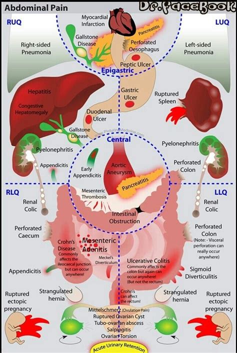 Abdominal surface anatomy can be described when viewed from in front of the abdomen in 2 ways: Abdominal Pain | cuteness | Pinterest