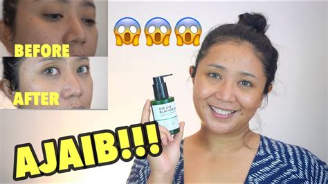 Bila ada orang yang ingin. REVIEW SOMEBYMI BYE BYE BLACKHEAD CLEANSER CARA GAMPANG ...