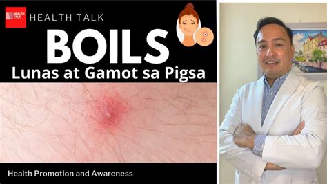 Boils Pigsa Causes Symptoms Treatment And Prevention Youtube