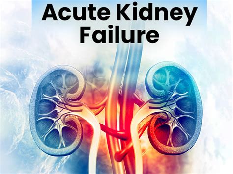 Acute Kidney Injury Acute Kidney Failure Causes Symptoms Risk