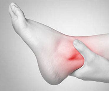 Artrosi Di Caviglia Sintomi E Trattamenti Disponibili
