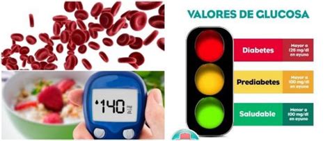 Valores Normales De Glucosa Tablas De Los Rangos De Los Niveles De Azucar En La Sangre