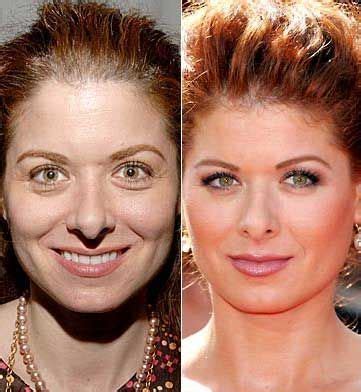 Most Popular Celebrity Nose Jobs Before And After With Images Fabbon