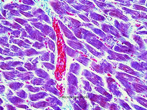 Microscope World Blog Human Cardiac Muscle Under The Microscope