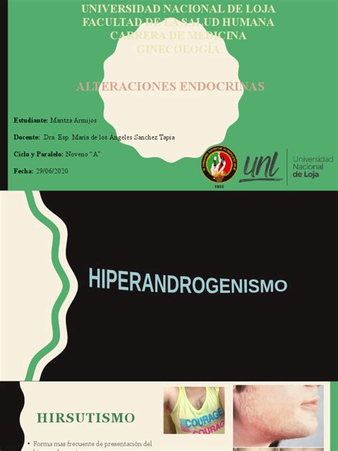Hiperandrogenismo Sop Hiperprolactinemia Pdf Ginecología La Salud