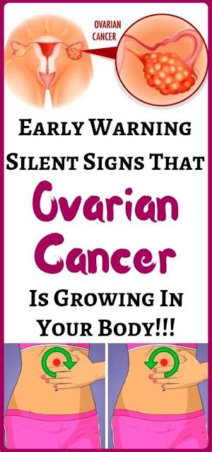 7 Signs Of Ovarian Cancer You Might Be Ignoring Wellness Magazine