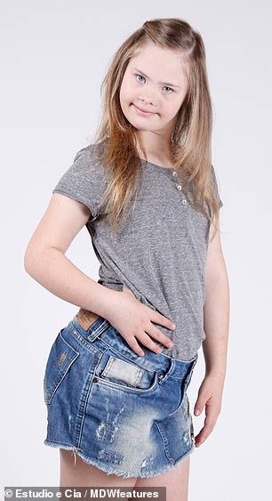 Model With Down S Syndrome Has Followers And Is Signed To