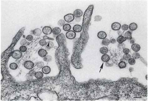 Electron microscopy reveled that hantaviruses are spherical or oval particles with a diameter of 80 to 210 nm fig 3. hantavirus: Hantavirus Electron Microscope