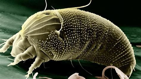 La scabbia una delle malattie infettive più antiche al ...