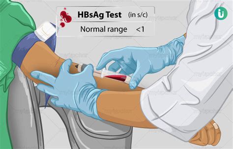 एचबीएसएजी टेस्ट क्या है खर्च कब क्यों कैसे होता है hbsag test normal range price cost