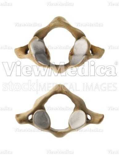 Viewmedica Stock Art Atlas C1 And Axis C2 Cervical Vertebrae With
