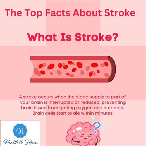 The Top Facts You Should Know About Stroke Fitness And Health Nextfitlife