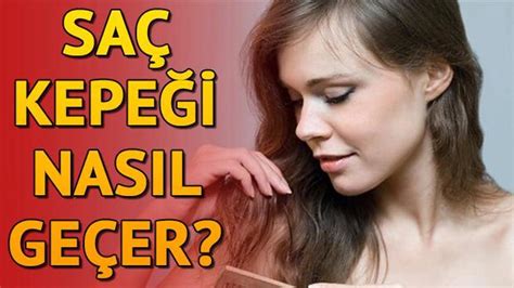 Saç kepeğine ne iyi gelir ve nasıl geçer? Saç kepeği neden olur? Evde