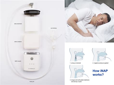 Is This New Inap Sleep Device Just As Good As Cpap Any Of You Try It Before Apnea Board