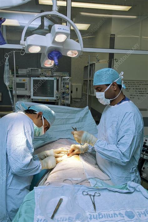 Hernia Operation Stock Image C0044032 Science Photo Library